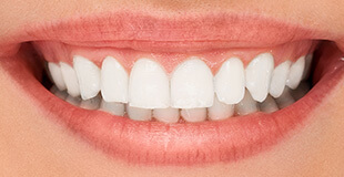 SEO for Dentistry